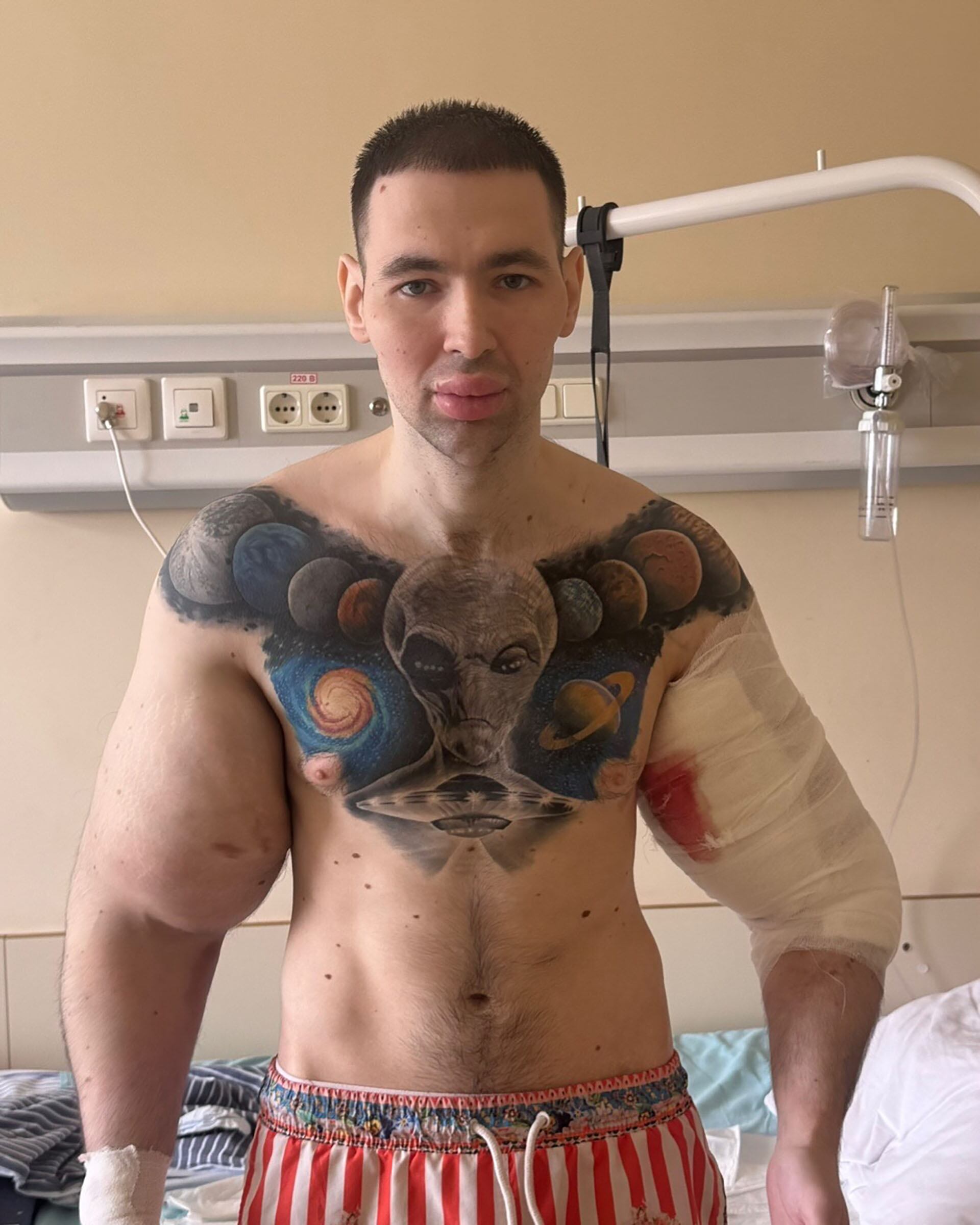 El Popeye Ruso en el hospital con con su brazo izquierdo vendado (@kirilltereshin96)