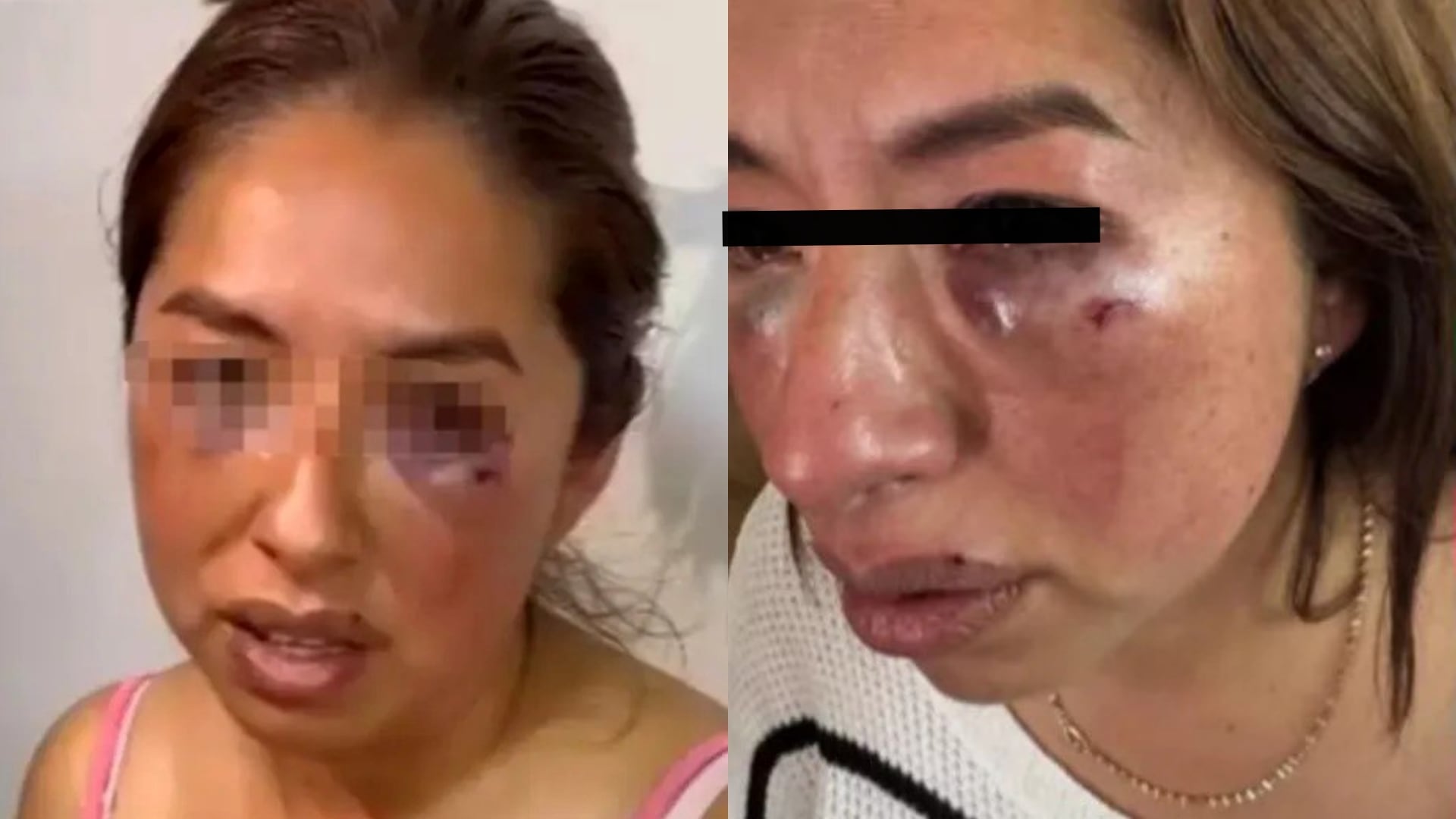 Lesiones de la víctima, identificada como Miriam