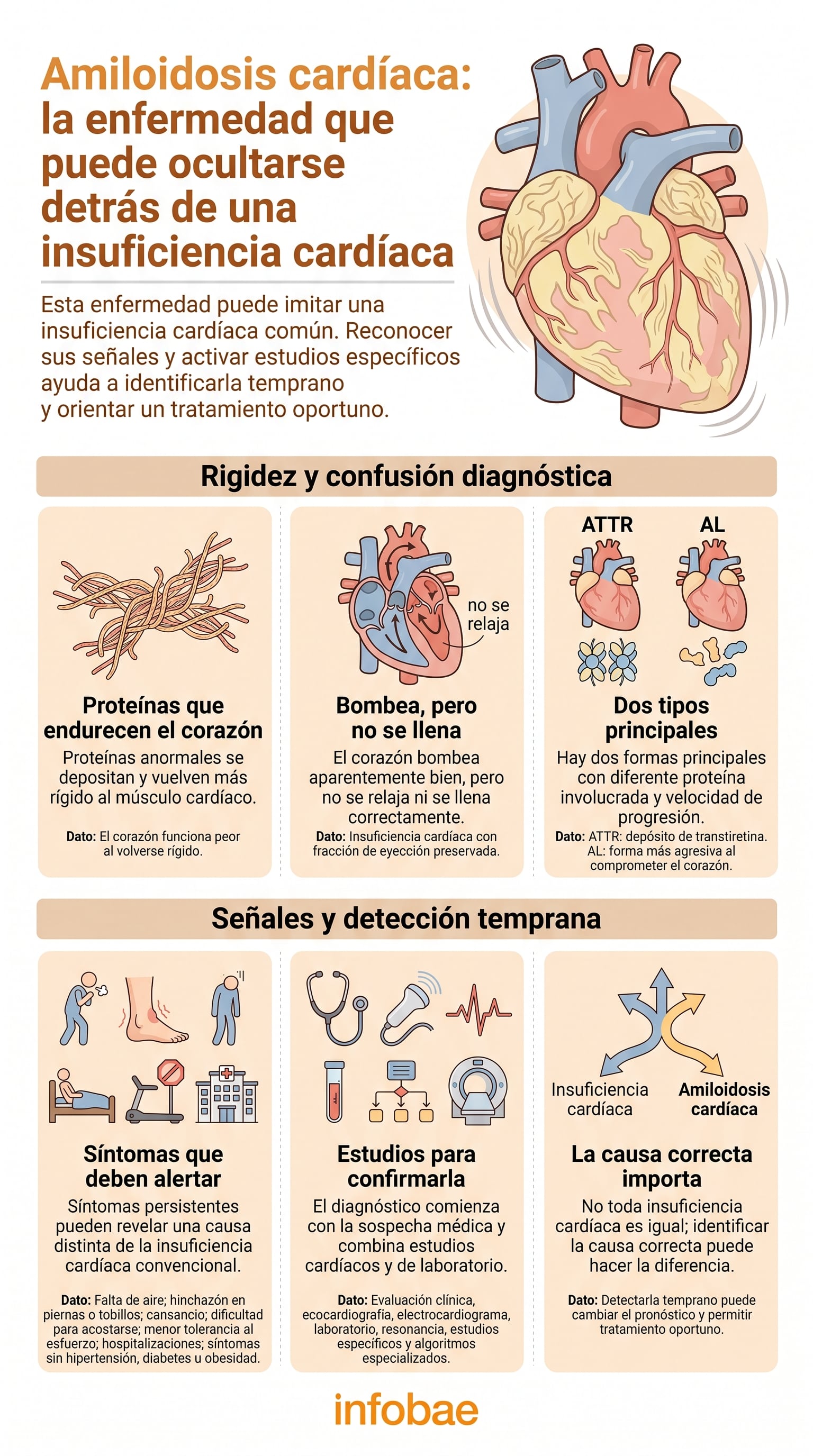 La amiloidosis cardíaca puede confundirse con otras formas de insuficiencia cardíaca. Reconocer señales de alerta y realizar estudios específicos permite identificar la causa y orientar el tratamiento de manera oportuna. (Imagen Ilustrativa Infobae)