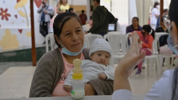 Niños con labio fisurado y paladar hendido podrán acceder a cirugías gratuitas: ¿Cómo inscribirlos?