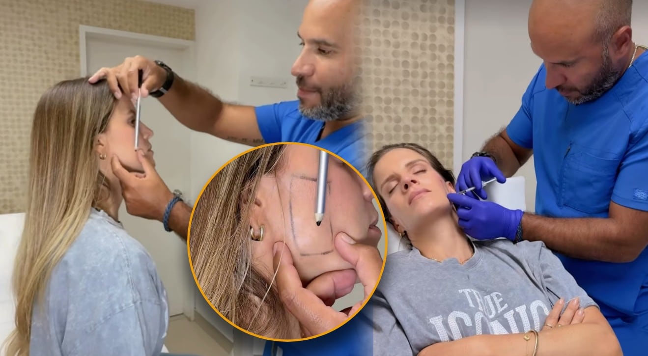 Ale Baigorria se aplica bótox tras ser diagnosticada con bruxismo en medio de rumores de separación. Captura: @alejandrabaigorria.