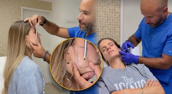 Ale Baigorria se aplica bótox tras ser diagnosticada con bruxismo en medio de rumores de separación. Captura: @alejandrabaigorria.