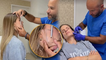 Alejandra Baigorria padece bruxismo y se aplica bótox en medio de crisis con Said Palao: “Por el estrés”