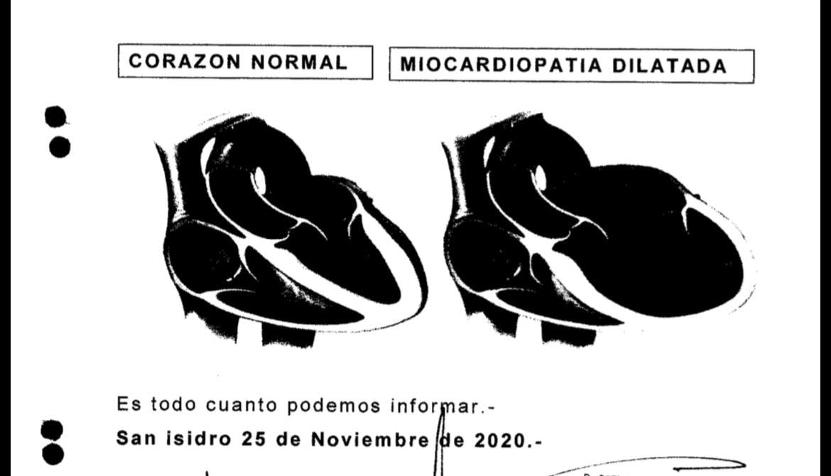 La diferencia ilustrativa entre un corazón normal y el de Maradona, según un documento de la causa