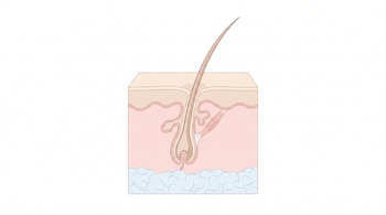 Vista en corte transversal de un folículo piloso humano en el cuero cabelludo, con capas de piel visible: epidermis, dermis y tejido subcutáneo, sobre fondo blanco.