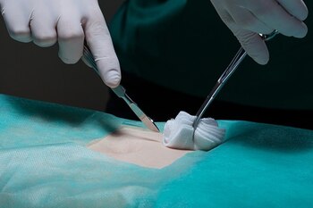 Cirujano realizando la incisión para