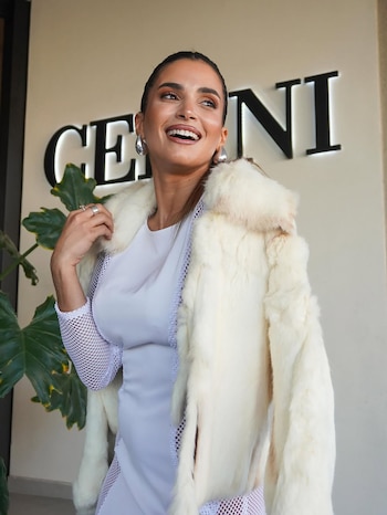 La empresaria resultó con traumatismo