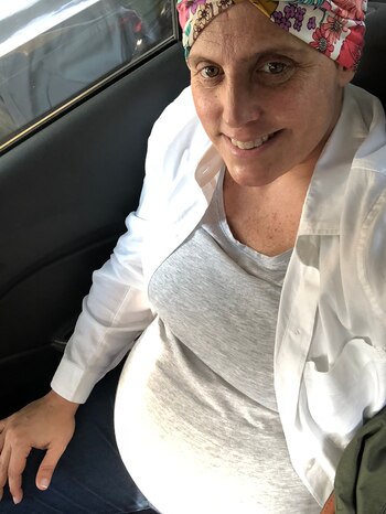 "La caída del pelo fue