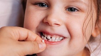 Por qué científicos en EE. UU. buscan dientes de leche de niños para rastrear contaminación de pozos petroleros