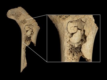 Fémur humano infantil hallado en