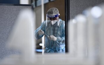 El suero equino tiene una