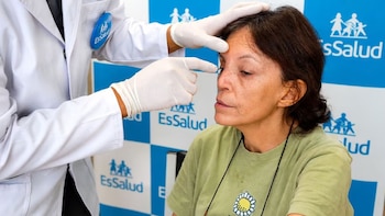 El daño severo comprometió no solo la apariencia del rostro, sino también la funcionalidad oral y nasal, lo que obligó a la paciente a vivir con restricciones severas en su vida diaria - Créditos: Essalud.