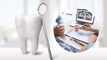 El uso de agentes químicos