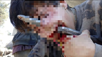 Barra de metal le atravesó