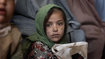 Más de 17 millones de