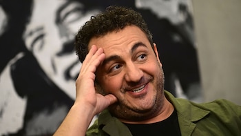 Diego Topa se hizo un retoque estético y el resultado impactó a sus seguidores: “Rejuveneció”