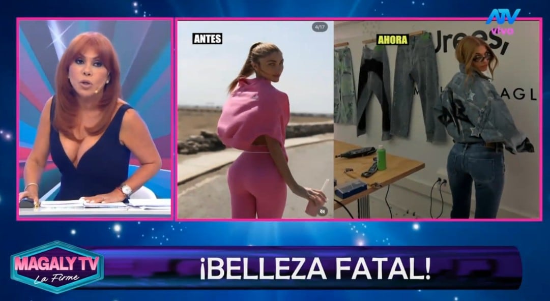 Alessia Rovegno preocupa a sus seguidores por su salud y Magaly Medina reflexiona sobre los estándares de belleza