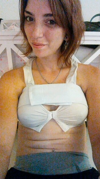 Informe - Adios Implantes