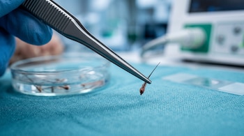 Una pinza metálica sostiene un folículo capilar sobre una tela azul quirúrgica junto a una placa de Petri y un equipo médico.
