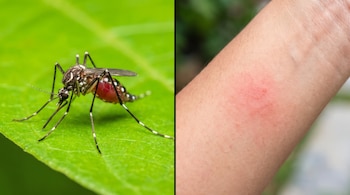 Imagen dividida con un mosquito sobre una hoja verde a la izquierda y una roncha roja sobre la piel de un brazo a la derecha.