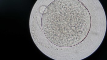 La exposición a metales pesados