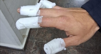 Tres adolescentes quemaron a un policía con una bomba molotov y fueron detenidos en Córdoba