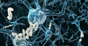 La enfermedad de Alzheimer es la causa principal de demencia y afecta actualmente a más de 55 millones de personas en el mundo (gentileza: UC San Diego)