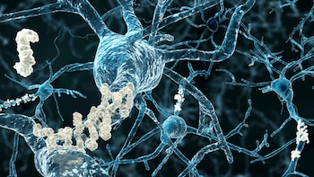 Por qué algunas personas con Alzheimer mantienen la lucidez y no presentan síntomas