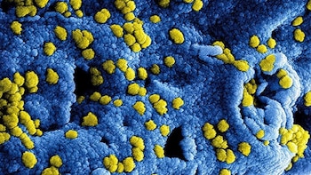 La OMS notifica 19 casos