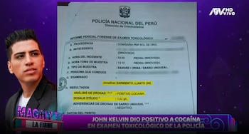 John Kelvin dio positivo a