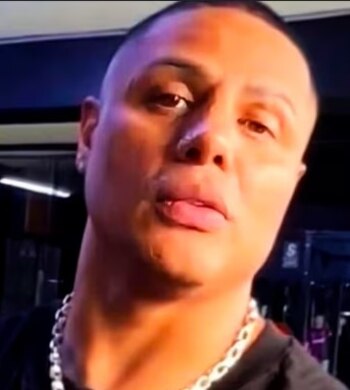 Alexandra Hörler defiende rinoplastia de