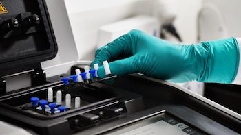 La UE destina 2,1 millones de euros a test PCR para la OMS contra el brote de ébola en RDC