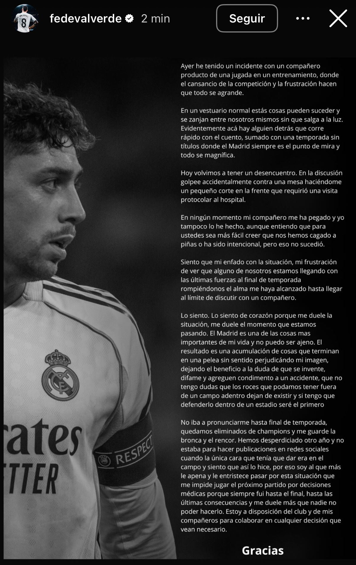 Federico Valverde aclaró en redes sociales el cruce que desencadenó en su hospitalización (Instagram)