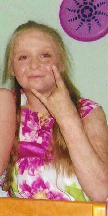 La niña sufría de piojos