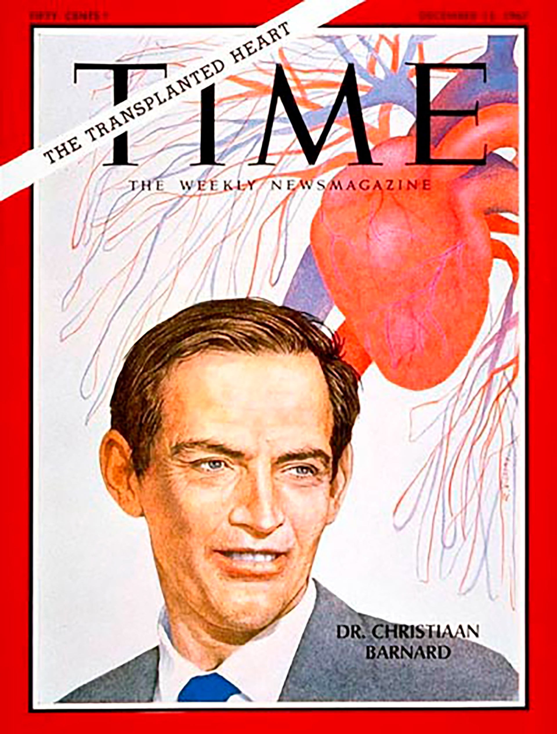 La noticia del primer trasplante de corazón fue portada en todos los diarios y revistas del planeta y el médico de 45 años, Christiaan Barnard, hasta entonces desconocido, saltó a la fama por su gran hazaña