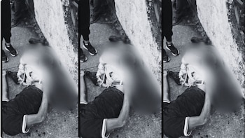 Perros habrían devorado el pie de un hombre que quedó atrapado en una reja: al parecer trató de golpear a los animales