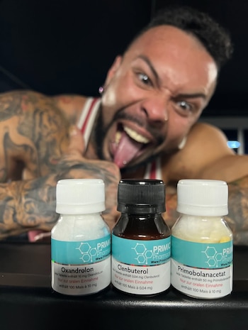 El fallecido mostraba algunos de