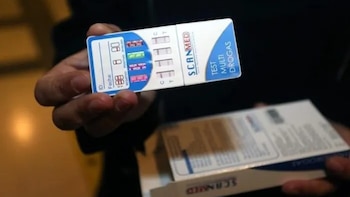 Los Diputados chilenos aprobaron un proyecto que exige test de drogas a quienes postulen a un cargo público