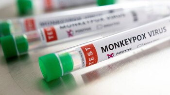 La viruela del mono llegó