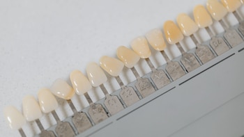 Los trucos para evitar tener los dientes amarillos, según los expertos (Canva)