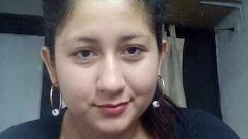 Mujer de 25 años sufre quemaduras de segundo y tercer grado en barrio Obrero: su expareja le prendió fuego y quedó libre por falta de flagrancia
