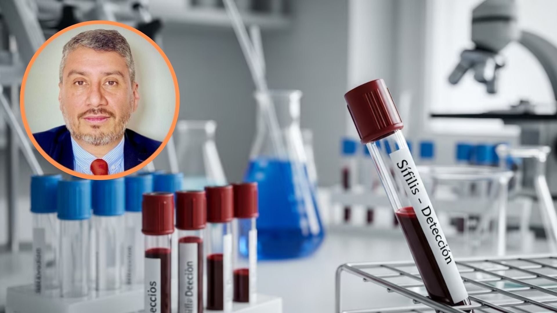 Duván Javier Rodríguez advierte: la sífilis crece en Colombia por prácticas de riesgo y diagnóstico tardío - crédito Imagen Ilustrativa Infobae - Suministrada a Infobae