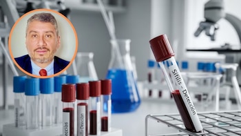 Duván Javier Rodríguez advierte: la sífilis crece en Colombia por prácticas de riesgo y diagnóstico tardío - crédito Imagen Ilustrativa Infobae - Suministrada a Infobae