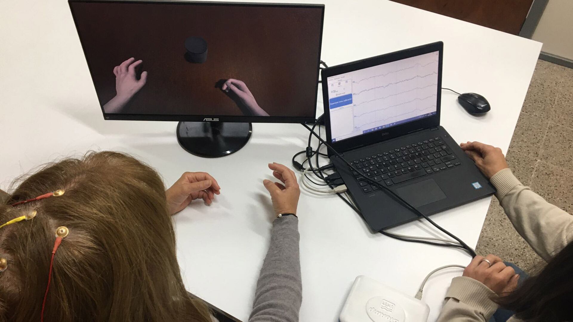 Así funciona el sistema en paciente que tiene la intención de mover la mano (UNER)