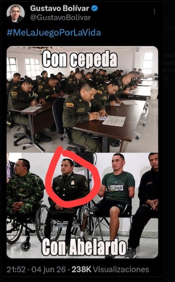 Gustavo Bolívar eliminó la publicación en X después de que generara críticas por el uso de imágenes de militares heridos en un mensaje de contenido político - crédito @63305748/X