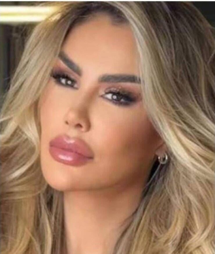 En la actualidad es una actriz con reconocida trayectoria, pero sigue siendo blanco de críticas por los diversos procedimientos quirúrgicos a los que se ha sometido para mantenerse en el medio. (Ninel Conde)