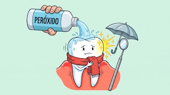 Blanqueamiento dental: cuáles son los riesgos de usar estos productos y qué recomiendan los odontólogos