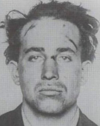 Fotografía en blanco y negro del rostro de un hombre de frente, con cabello oscuro desordenado y manchas oscuras sobre la frente