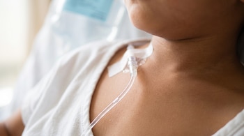 Primer plano del cuello y tórax de un niño con un catéter intravenoso, tubo médico, cinta adhesiva, bata de hospital blanca y bolsa de suero azul.