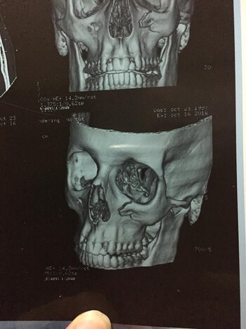 A raíz de la golpiza,